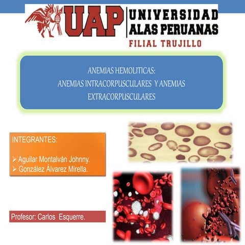 Anemia Hemolitica