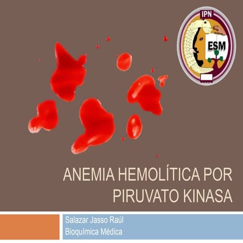 Anemia hemolitica por deficiencia de piruvato kinasa