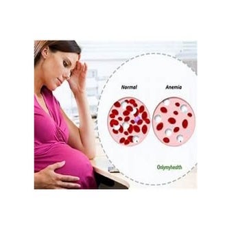 ANEMIA IN Pregnancy powerpoint presentation