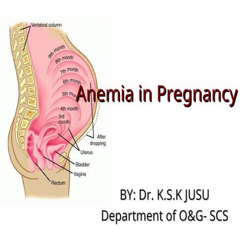 Anemia_Pregnancy Sept.08 2.ppthcxxjchfskoh