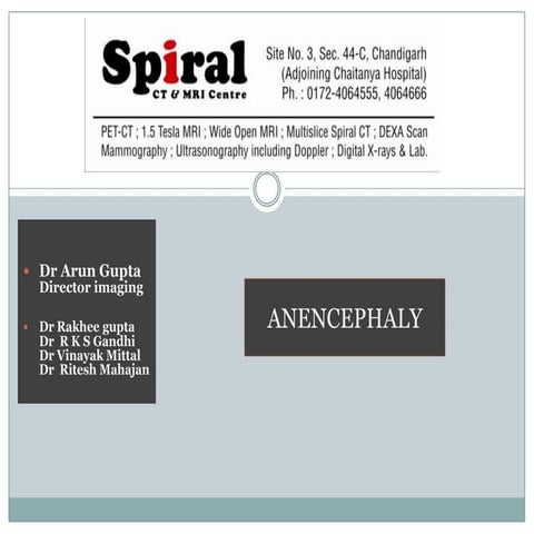 Anencephaly