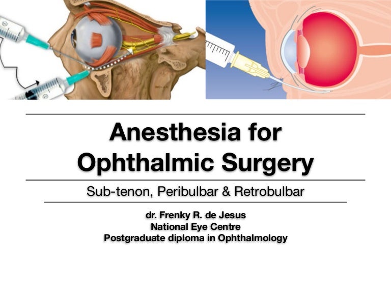 Anesthesia for Ophthalmic Surgery