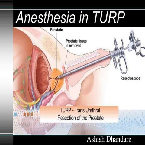 Anesthesia in Transurethral resection of prostate