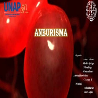 Aneurisma