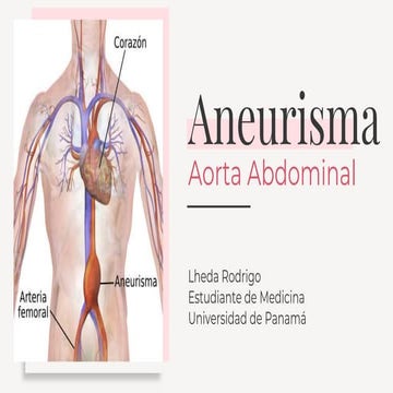caso clinico ANEURISMA DE LA AORTA ABDOMINAL.pptx