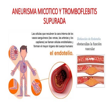 Aneurisma micotico 1 | PPTX