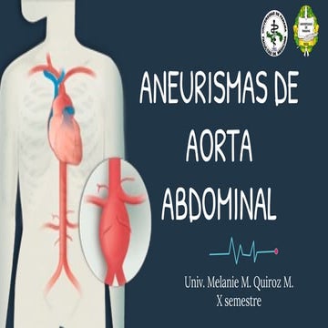 Aneurisma de la aorta abdominal | PPTX