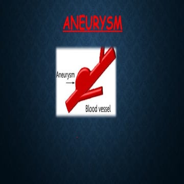 Aneurysm | PPTX