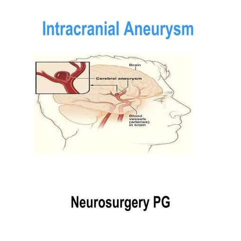 Aneurysms.pptx