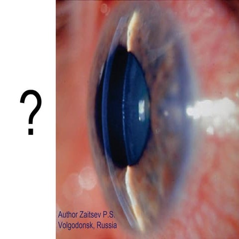 Ang.Closure Glaucoma