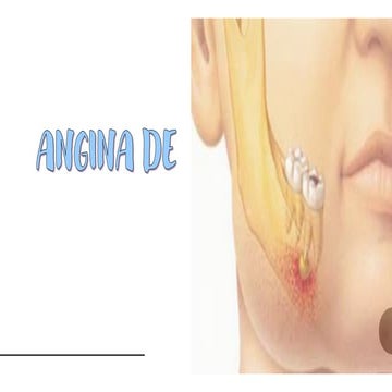 ANGINA DE LUDWIG.pptx
