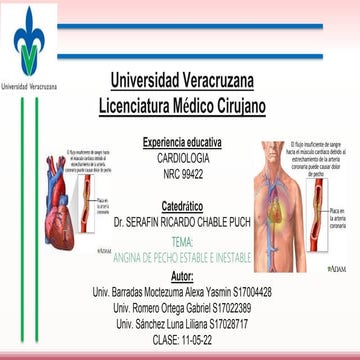 ANGINA DE PECHO ESTABLE E INESTABLE.pptx