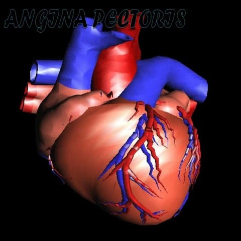 Angina pectoris
