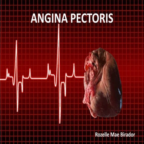 Angina Pectoris