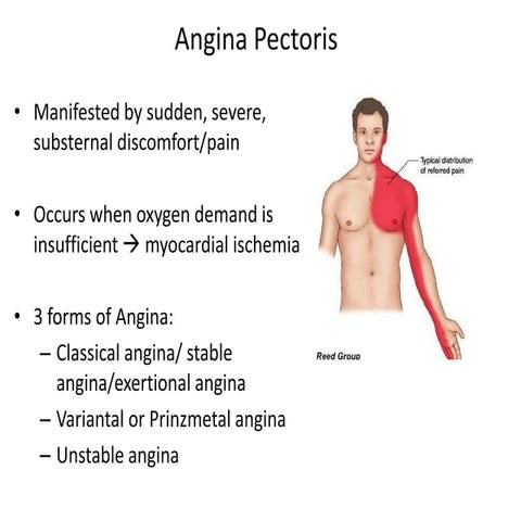 Angina pectoris