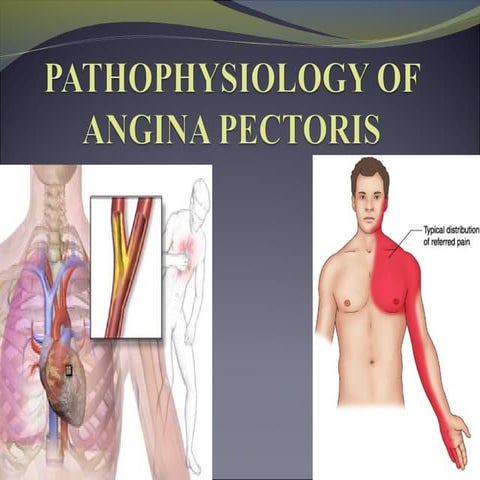 Angina pathophysiology