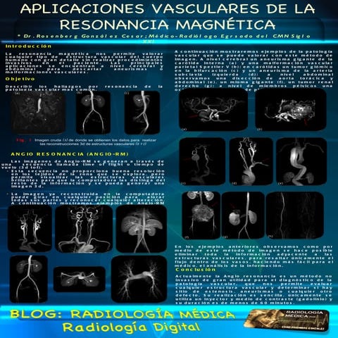 Angio RM blog