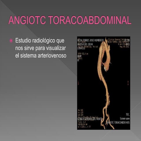angiotc-de-miembros-inferiores-pptx