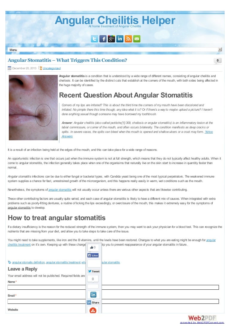 Angular Stomatitis What Triggers This Condition?