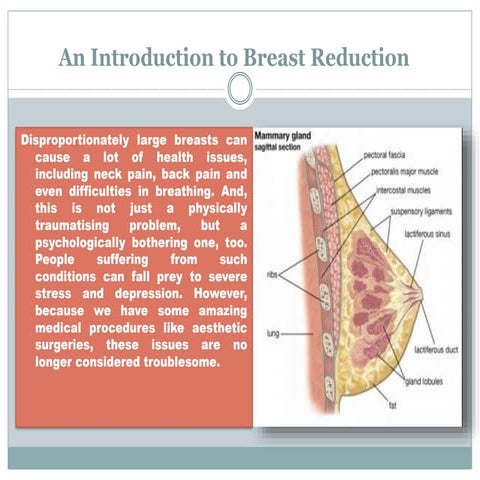 Know Everything About Breast Reduction