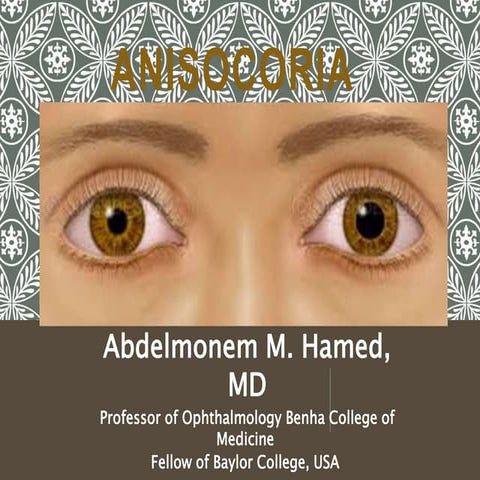 Anisocoria
