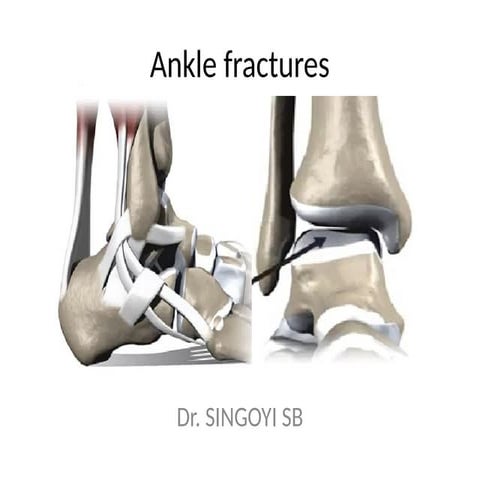 BIMALLEOLAR FRACTURES mechanism and anapath.pptx