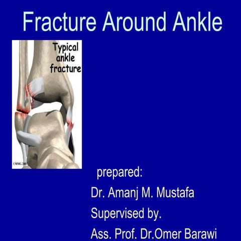 Ankle injury amanj