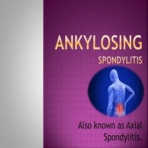 Ankylosing Spondylitis 1 Pptx