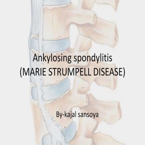 Ankylosing spondylitis