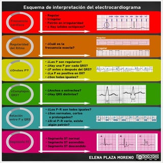 Esquema de interpretación del elect...