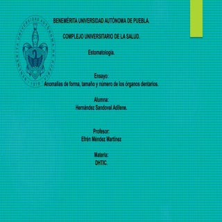 Anomalías dentales. (1)