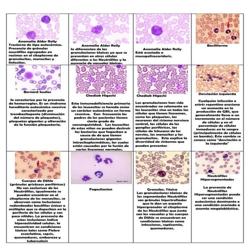 Anomalías leucocitos