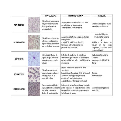 Anomalias eritrocitarias, cuadro ilustrativo.docx