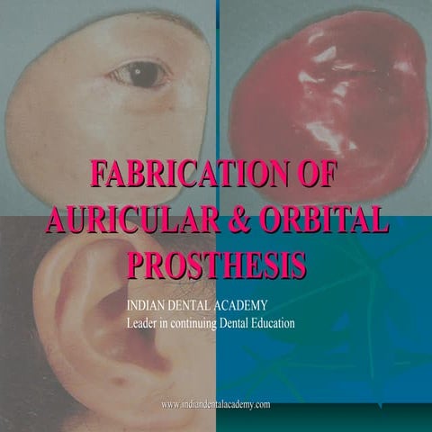 FABRICATION OF AURICULAR & ORBITAL  PROSTHESIS/orthodontic courses by Indian ...