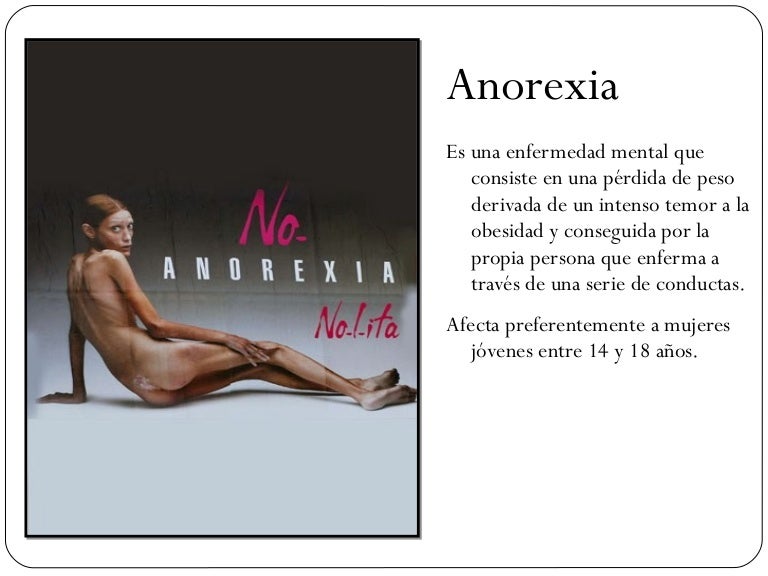 Anorexia