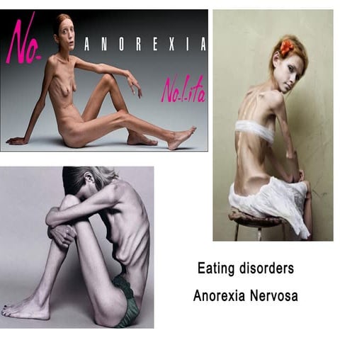 Psychological explanations of anorexia A2