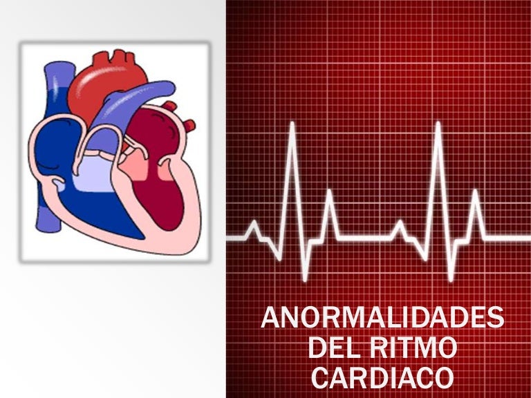 Como é Chamada A Aceleração Anormal Do Ritmo Cardíaco