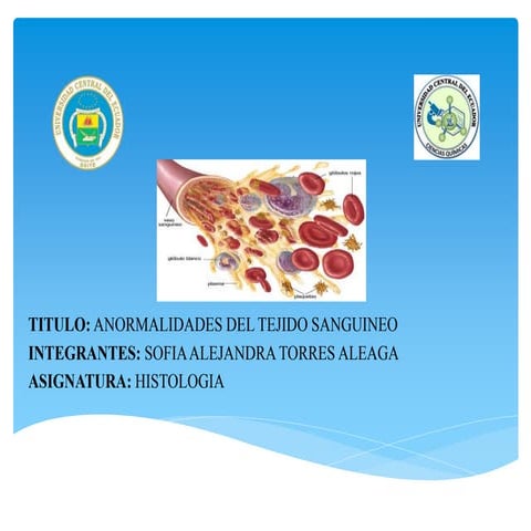Anormalidades del tejido sanguíneo  - Alejandra Torres 