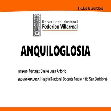 ANQUILOGLOSIA.pptx