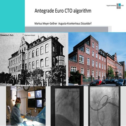 Meyer-Geßner - Session 1 - Antegrade euro cto algorithm | PDF
