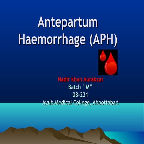 Antepartum haemorhage