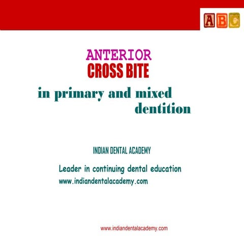 Anterior crossbites in primary & mixed dentition Orthodontic courses training...