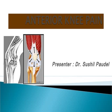 Anterior knee pain