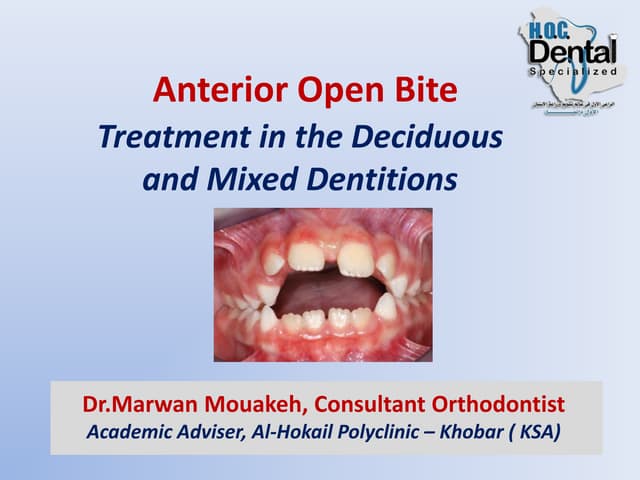 Anterior open bite  treatment deciduous and mixed dentition   .slide