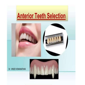 PARTS OF FIXED PARTIAL DENTURE.pptx