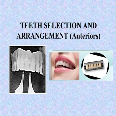 Anterior teeth selection in complete denture.pptx