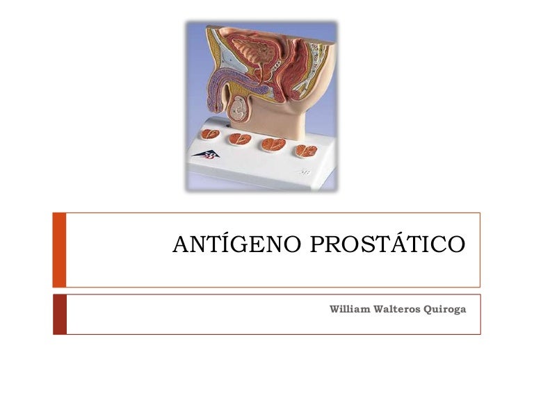 tasas de falsos positivos y falsos negativos para el antígeno prostático específico de psa