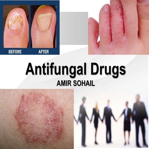 Antifungals drugs classification,mechanism of action uses and adverse effects