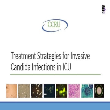 Fungal infections in the ICU | PPTX