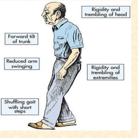 Antiparkinsonian drugs